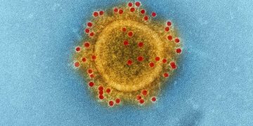 L’Organizzazione mondiale della sanità dichiara il Covid-19 «pandemia»