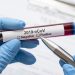 coronavirus test epidemia contagio